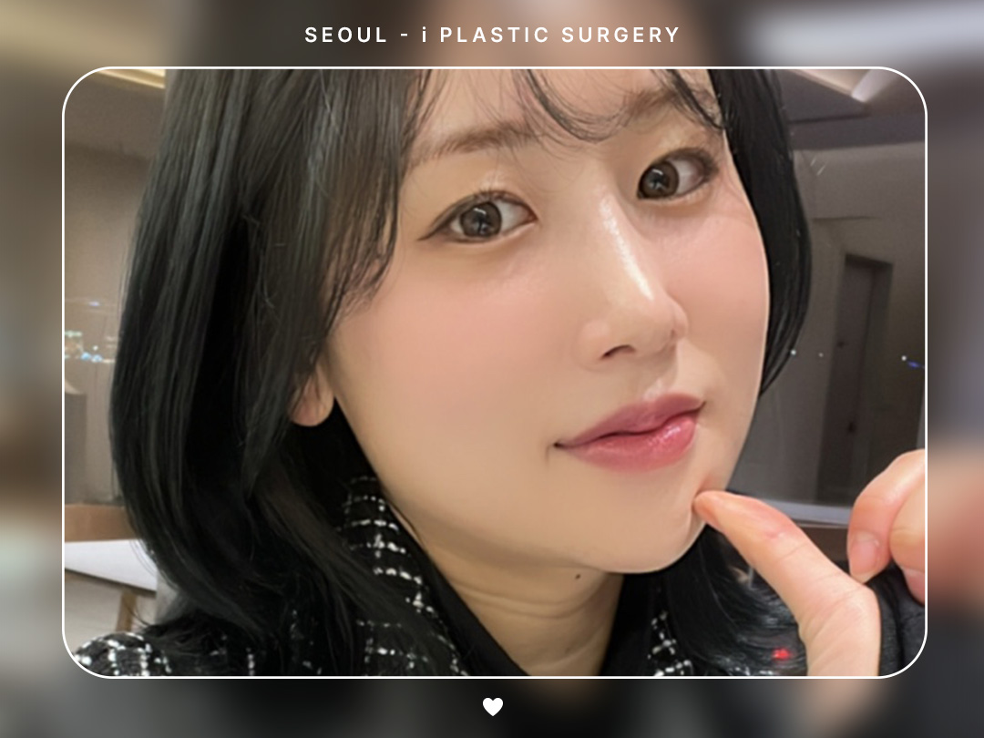 #미용코 #코끝 #복코교정