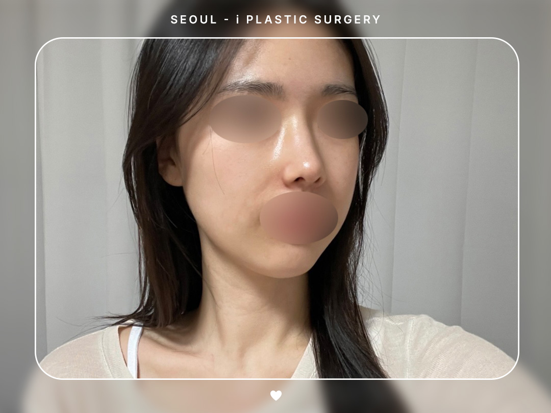 리얼셀카이미지