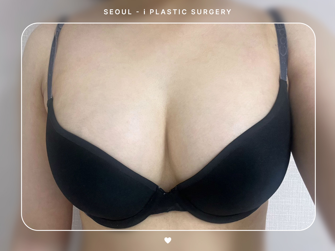 리얼셀카이미지