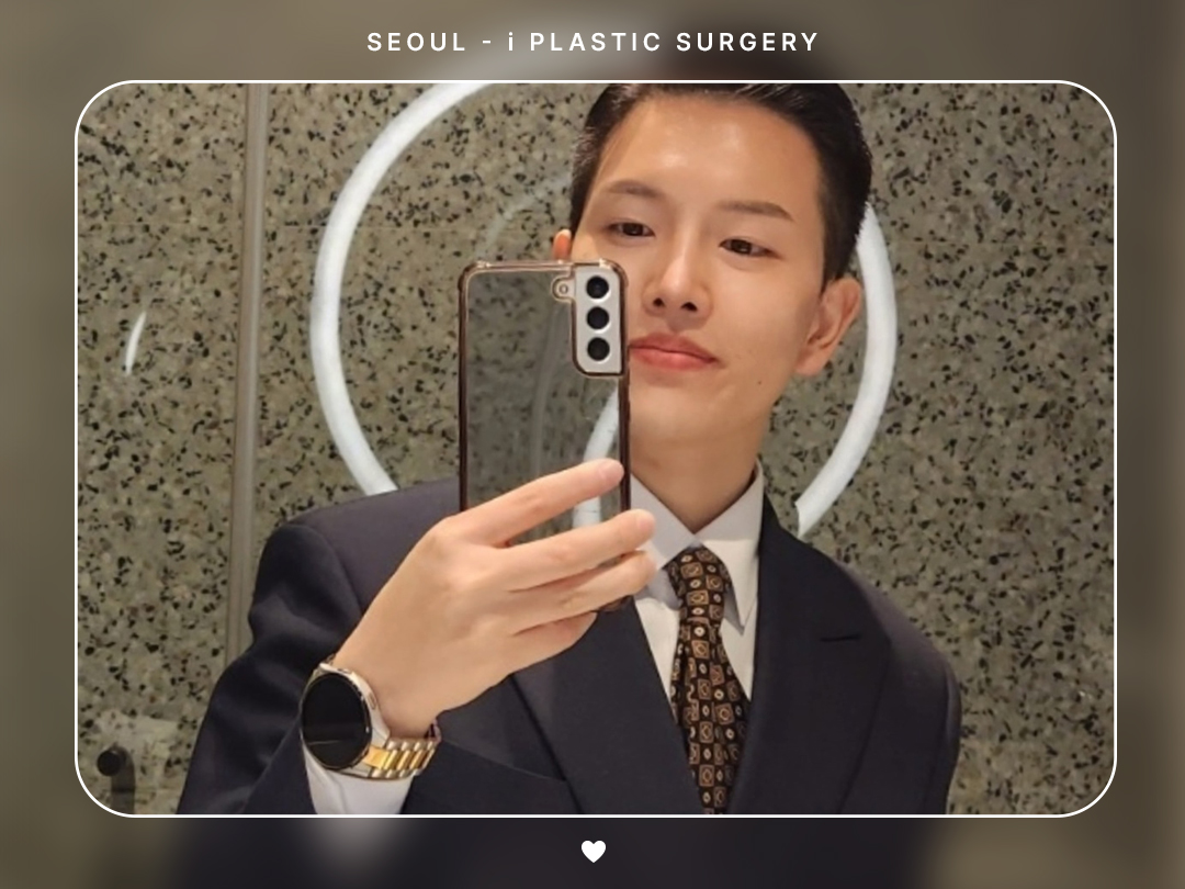 #미용코 #콧대 #복코교정