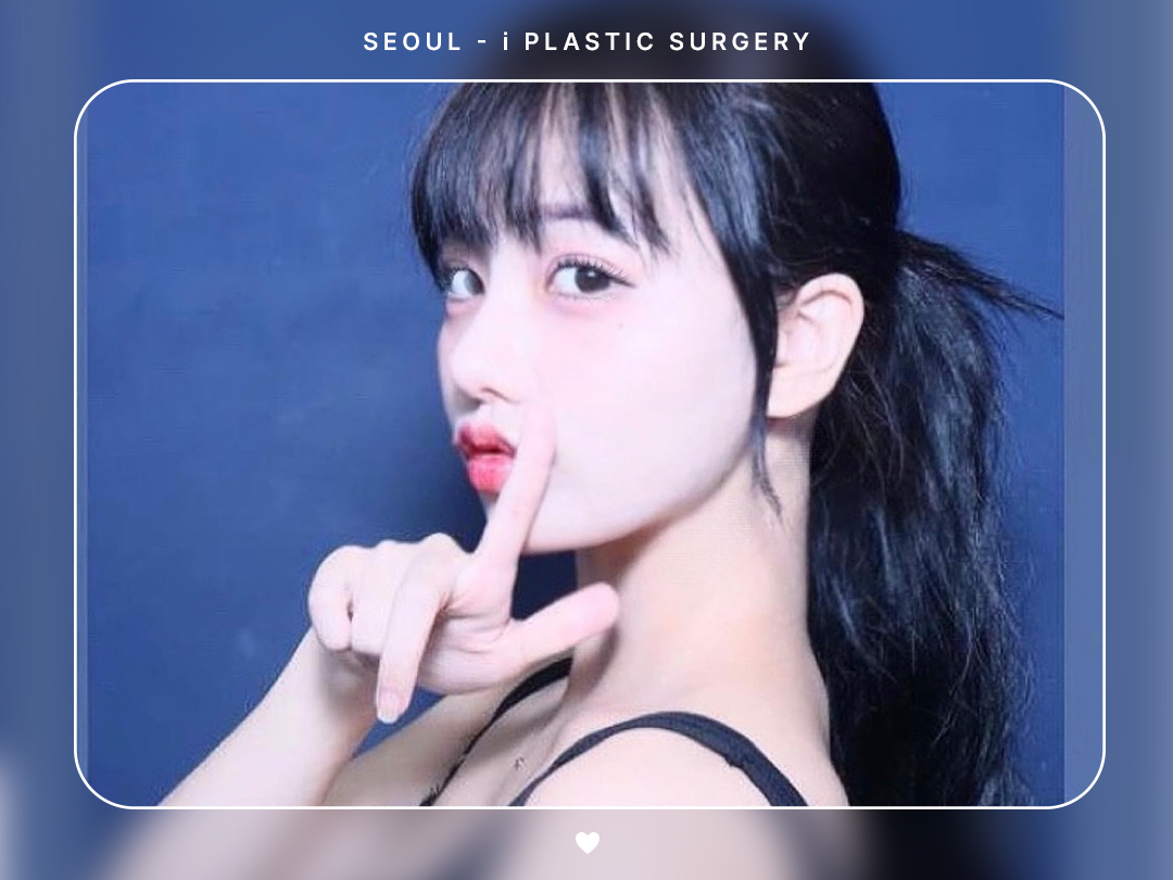 #미용코 #콧대 #코끝교정