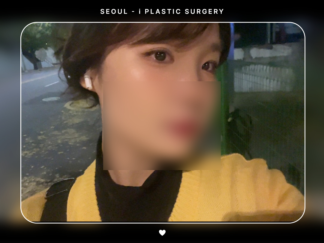 #자연유착 #앞트임