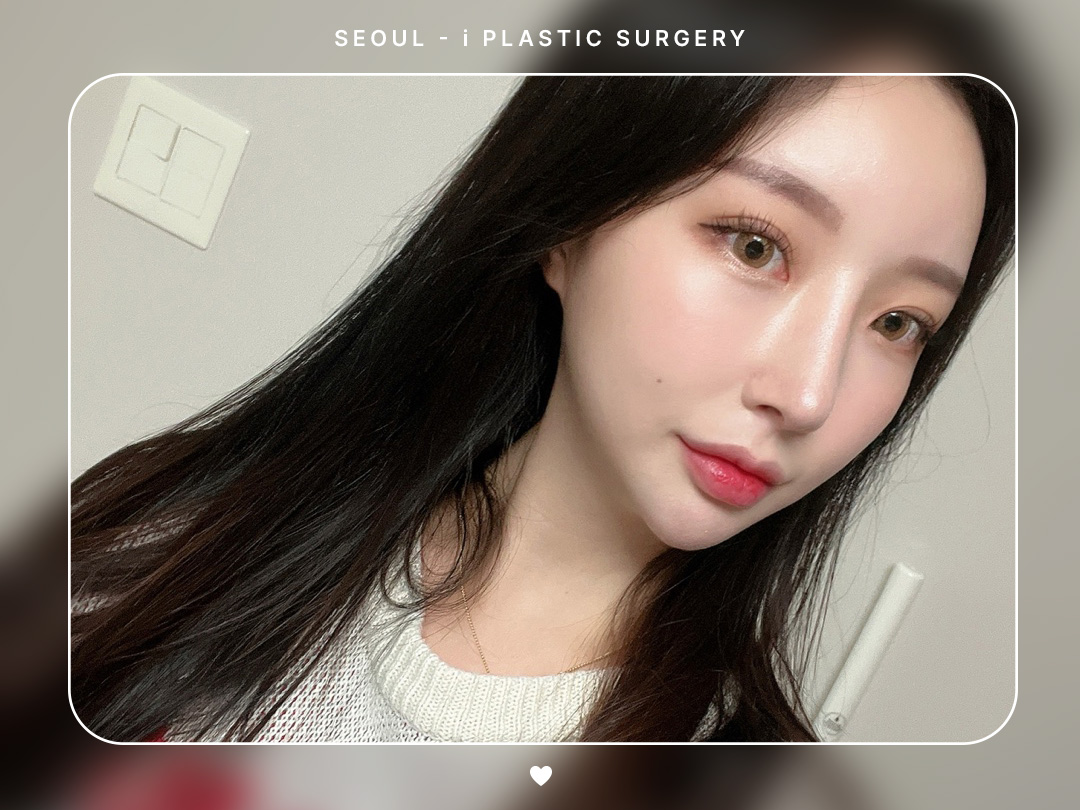 #미용코 #복코 #매부리코교정