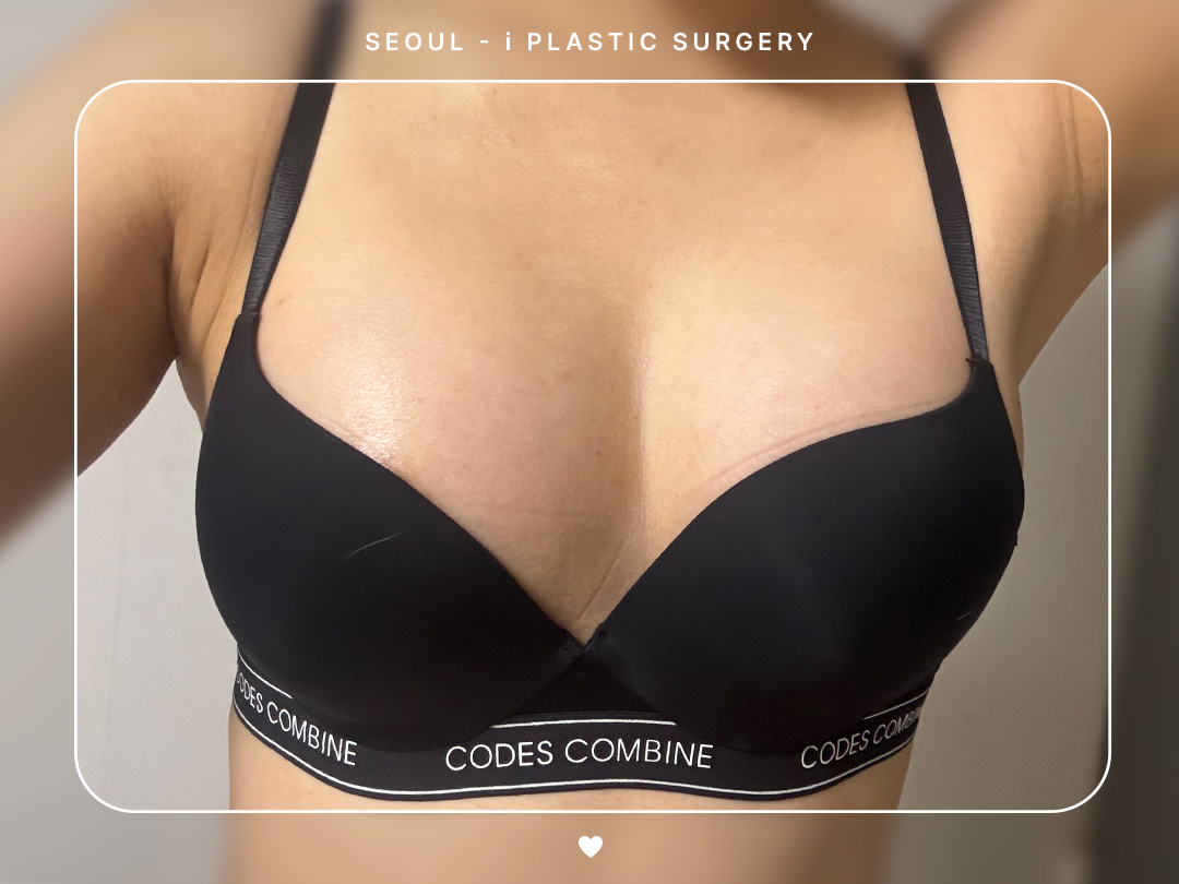 리얼셀카이미지