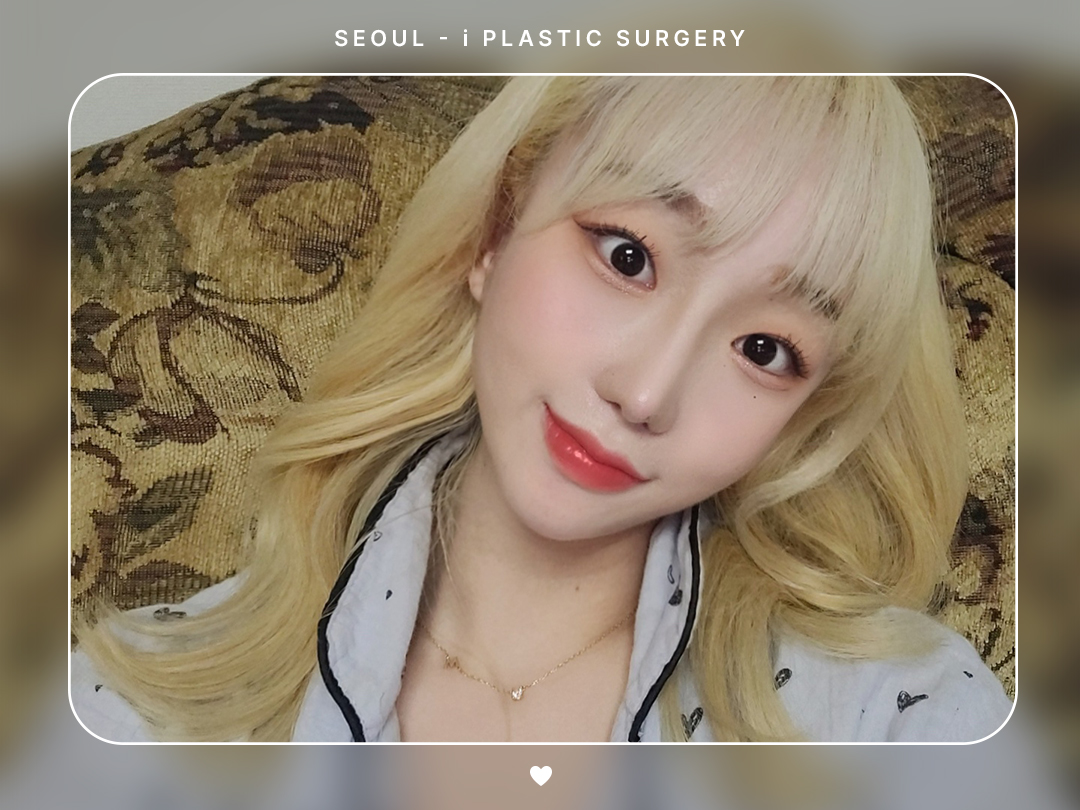 #미용코 #복코 #매부리코교정