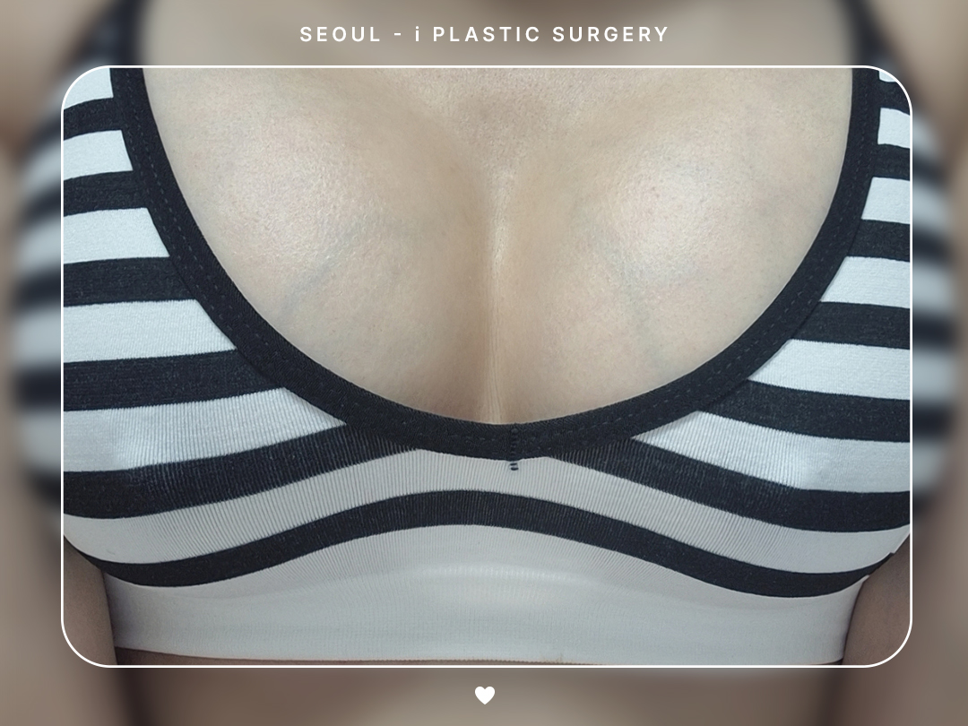 리얼셀카이미지