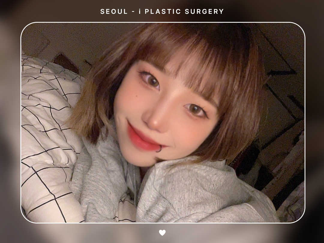 #미용코 #콧대 #매부리코교정