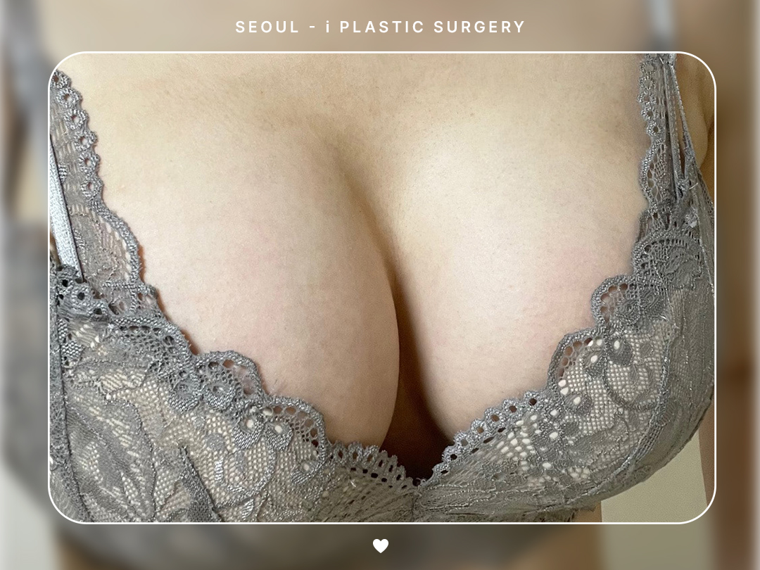리얼셀카이미지