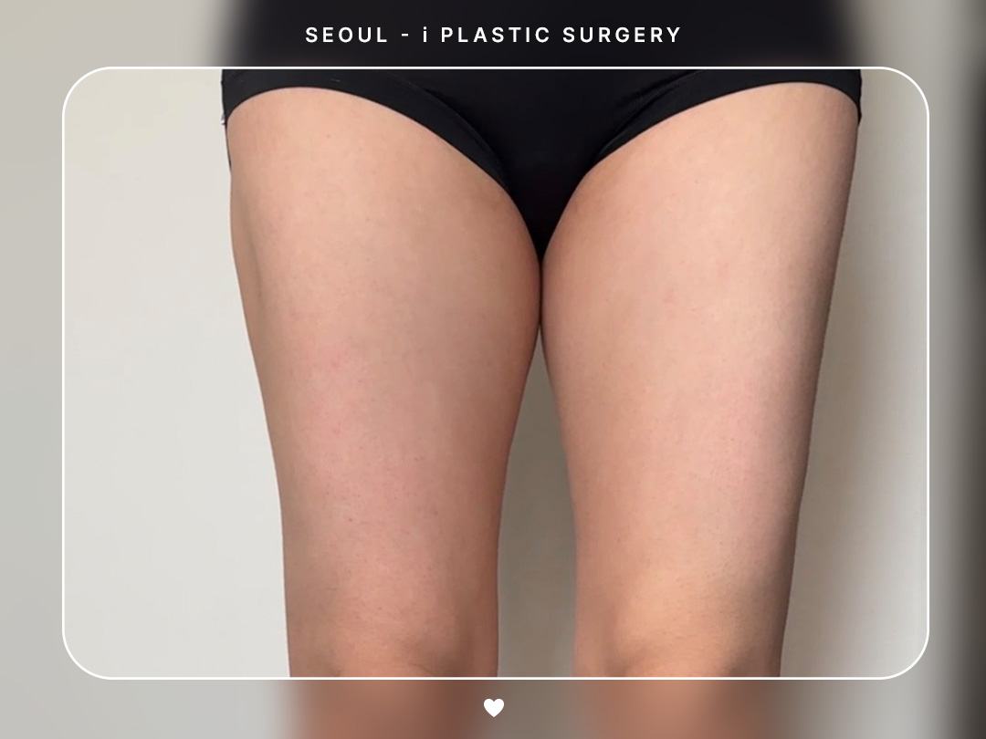 리얼셀카이미지
