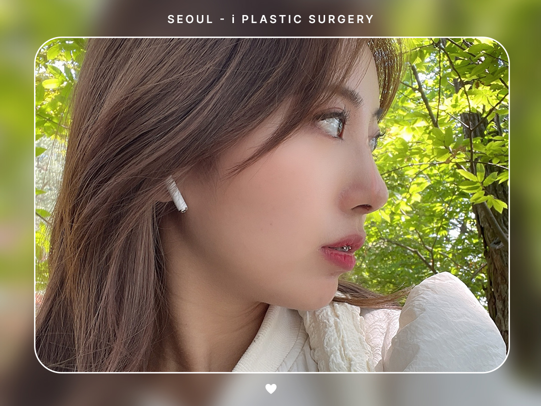 #미용코 #복코 #매부리코교정