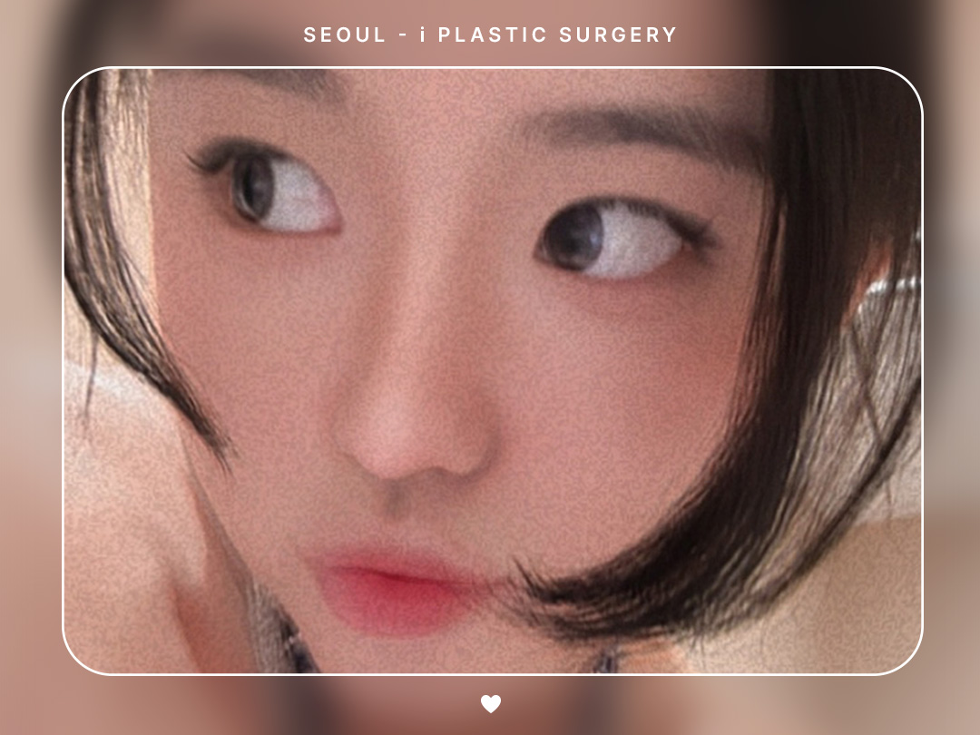 #미용코 #콧대 #코끝교정