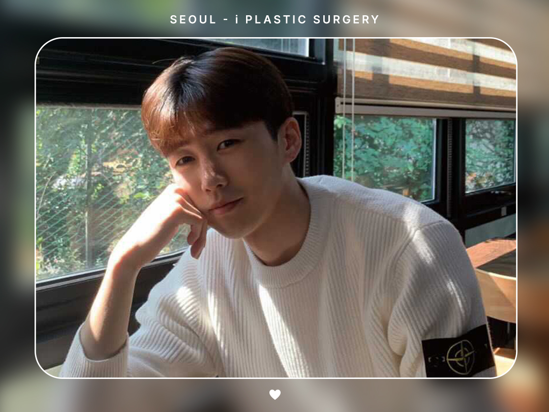 #미용코 #복코 #매부리코교정