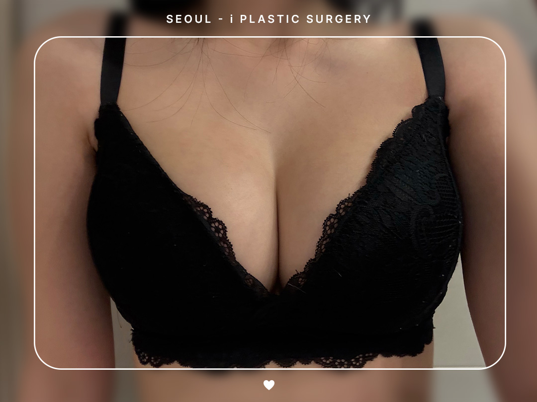 리얼셀카이미지