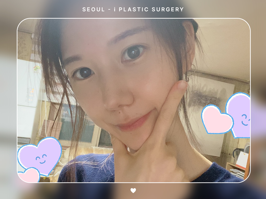 #자연유착 #눈매교정