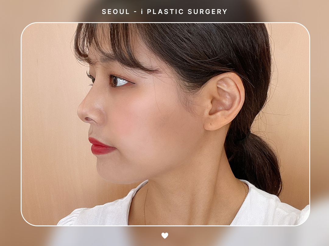 리얼셀카이미지