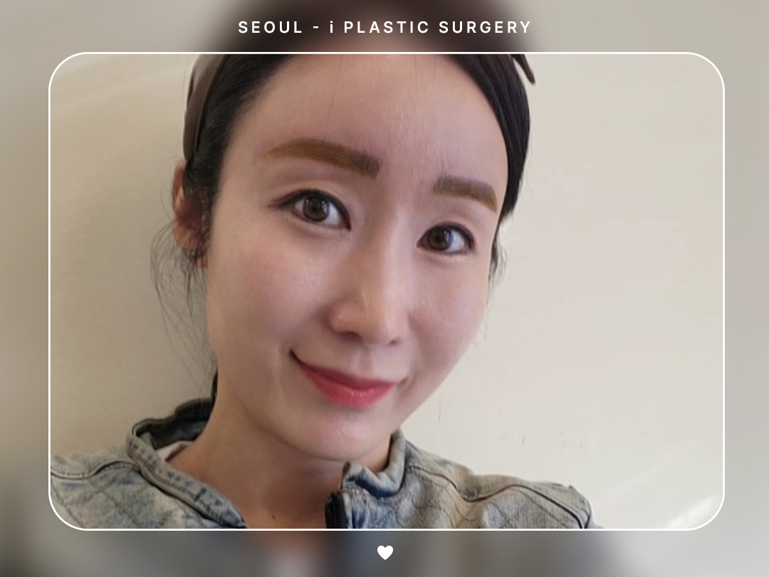 #리프팅 #실리프팅