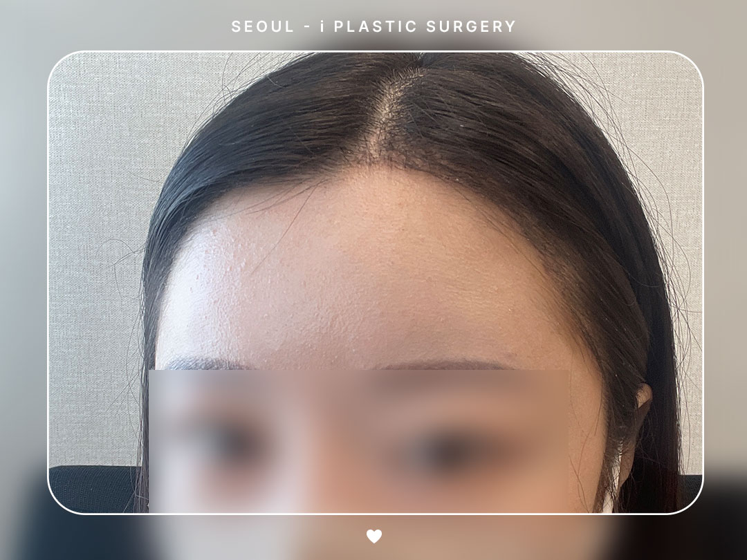 리얼셀카이미지