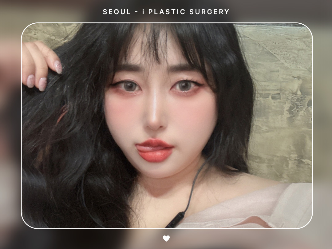 #미용코 #복코 #매부리코교정