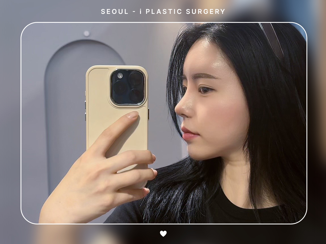 #미용코 #복코 #매부리코교정