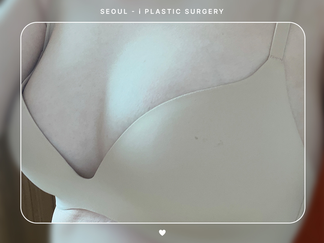 리얼셀카이미지
