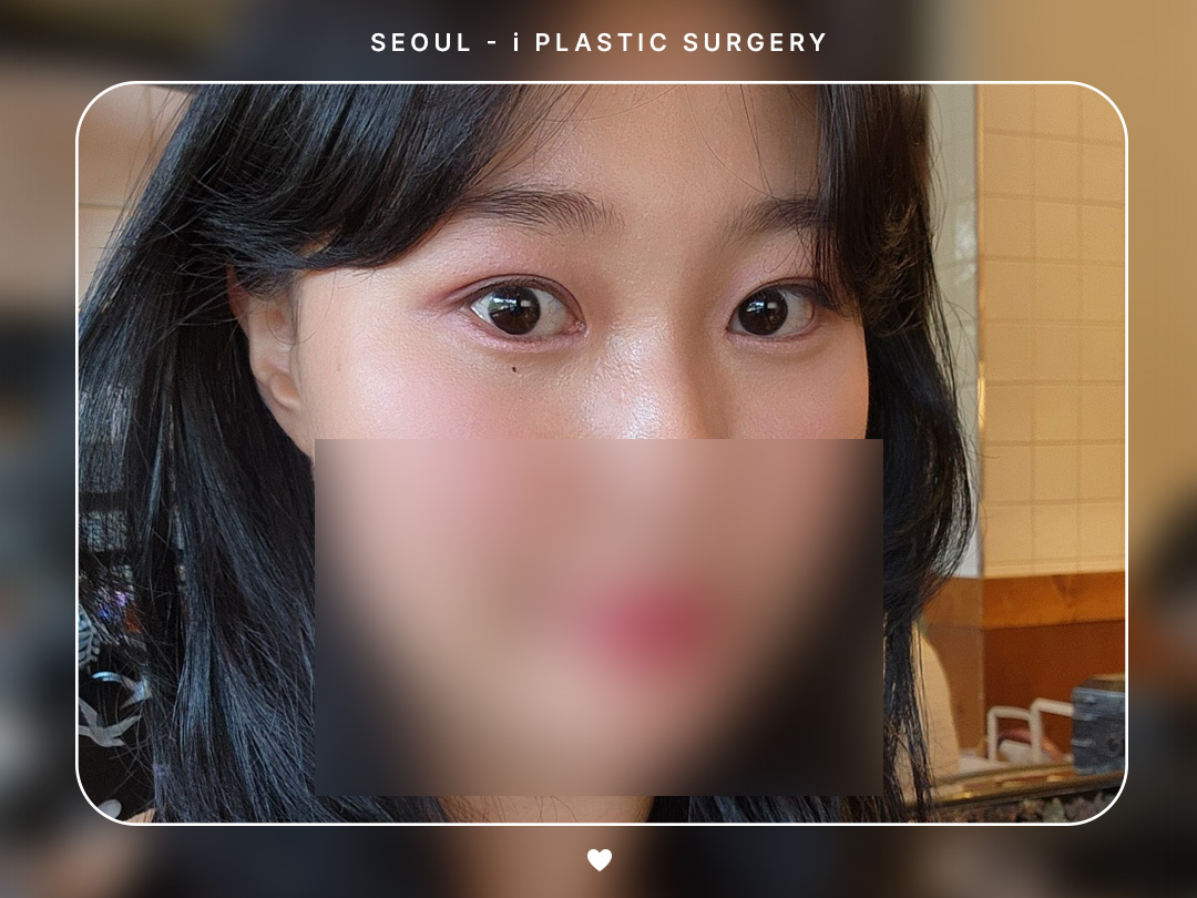 리얼셀카이미지