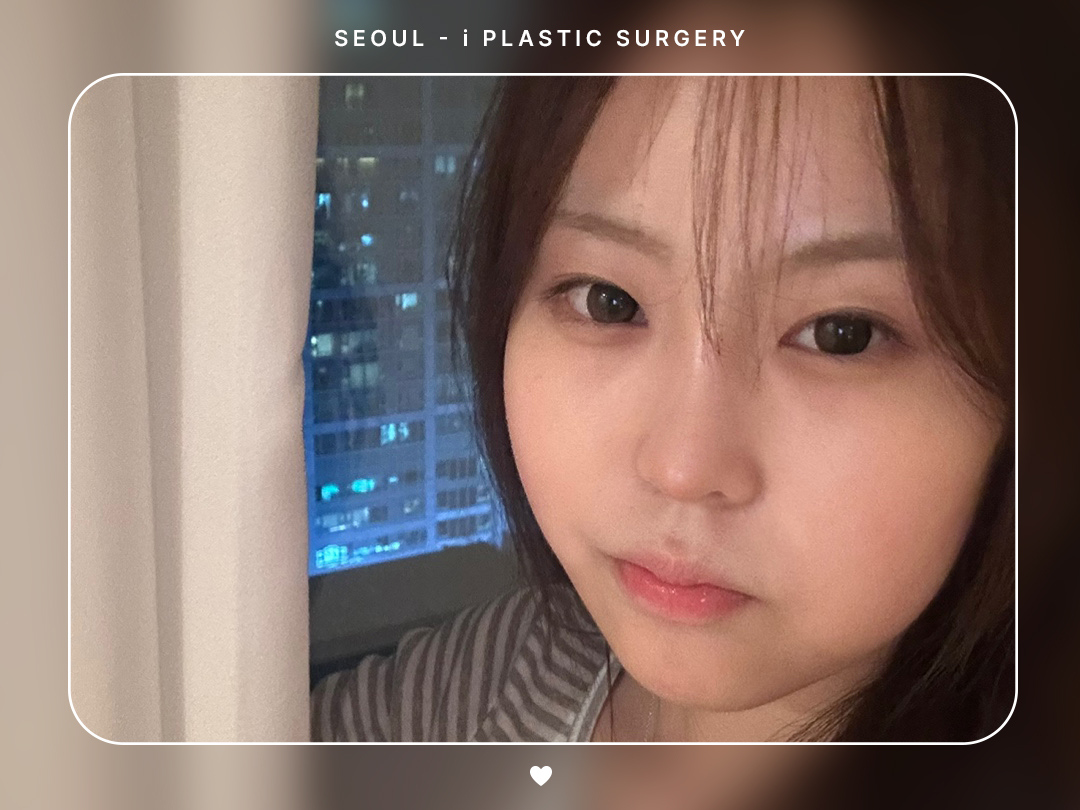 #미용코 #콧대 #코끝교정