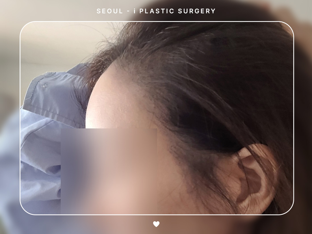 리얼셀카이미지