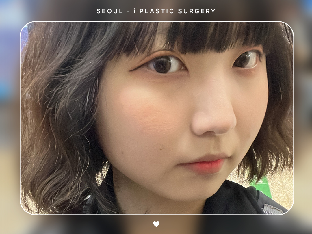 리얼셀카이미지