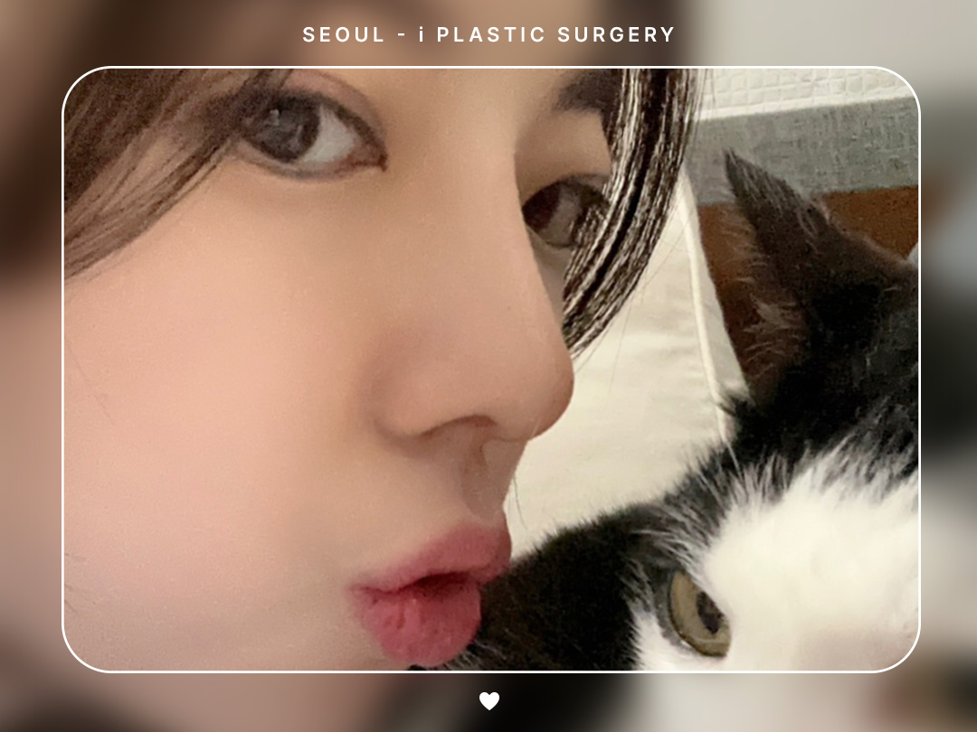 #미용코 #복코 #매부리코교정