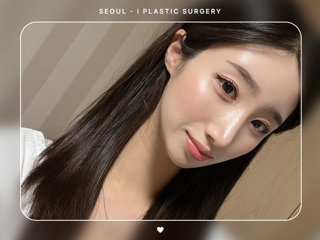 #미용코 #콧대 #매부리코교정