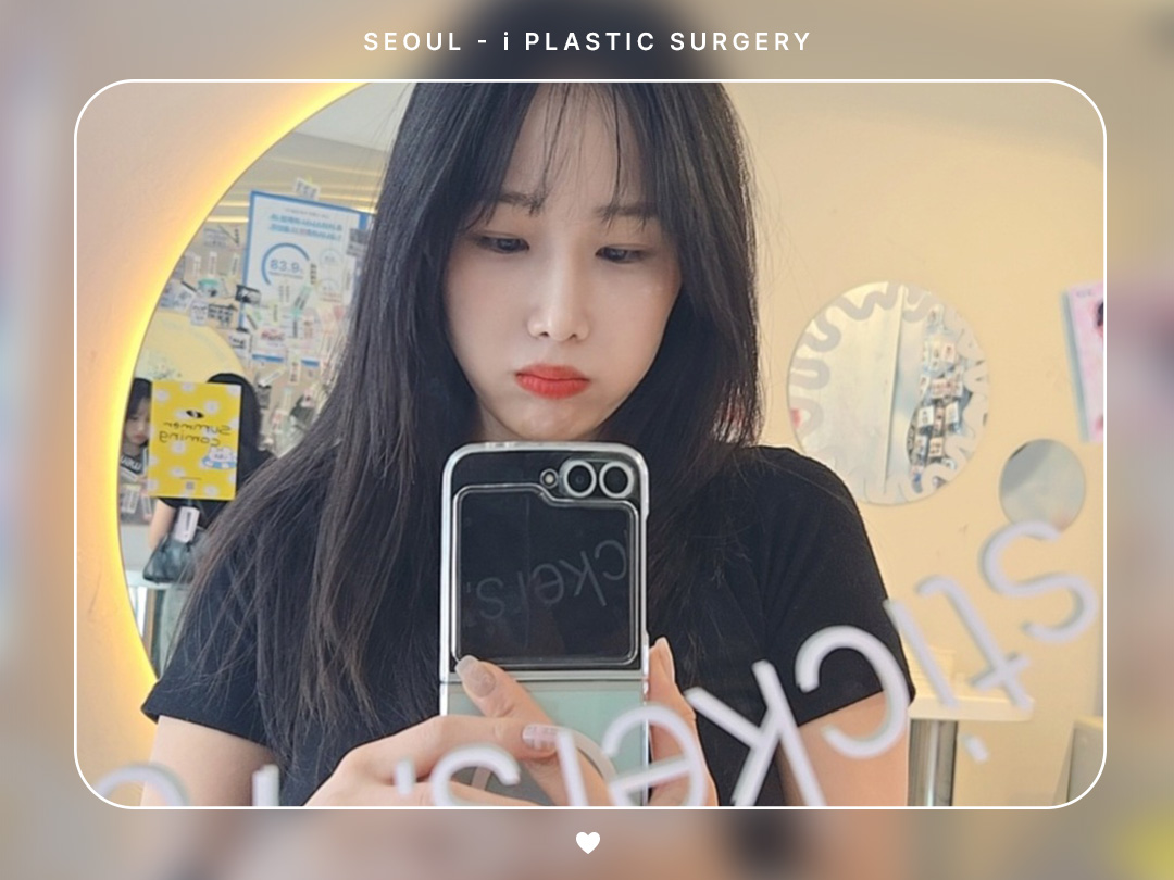 #미용코 #콧대 #매부리코교정