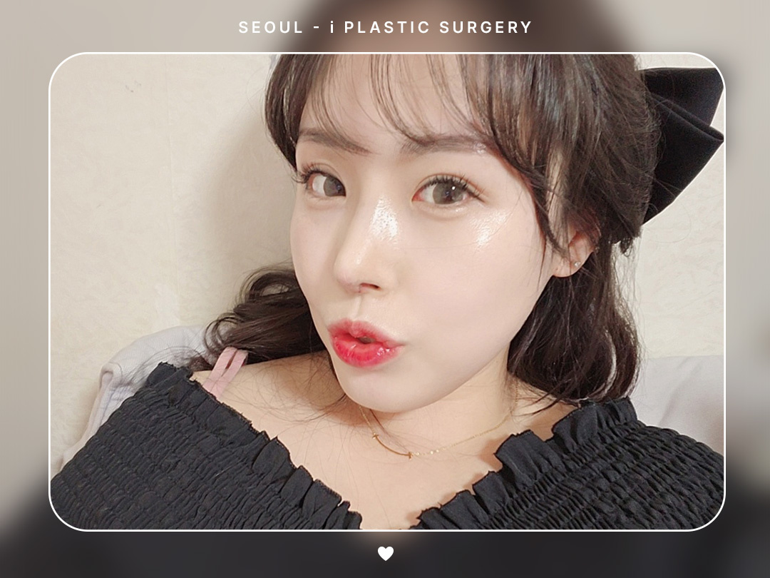 #미용코 #복코 #짧은코 #매부리코교정