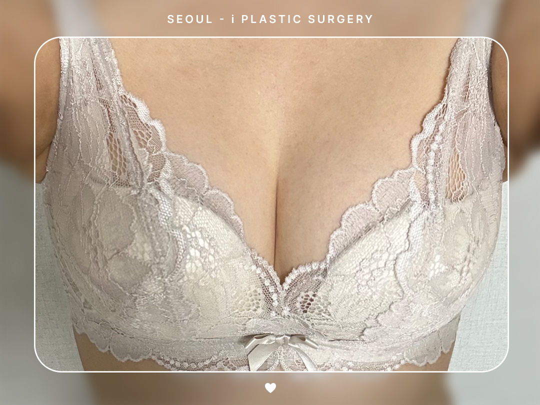 #가슴 #지방이식 #줄기세포 가슴지방이식