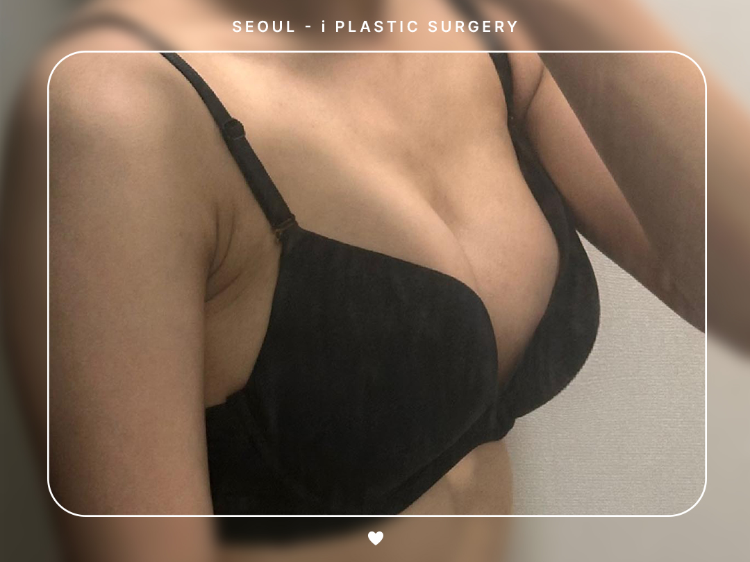리얼셀카이미지