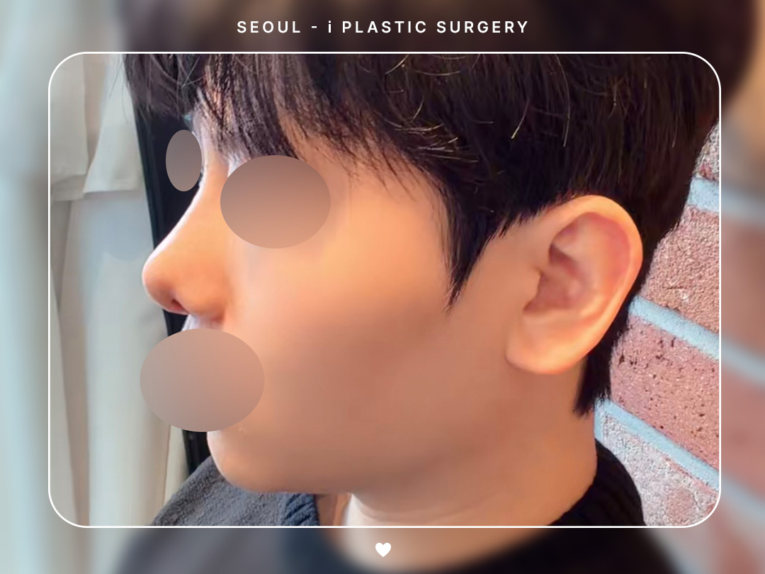 리얼셀카이미지