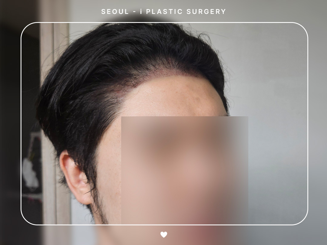 리얼셀카이미지