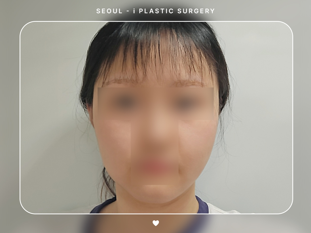 리얼셀카이미지