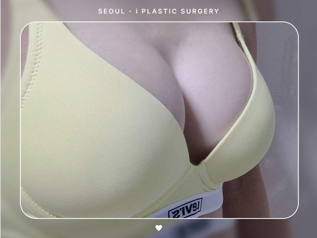 #가슴 #보형물 #내추럴가슴보형물