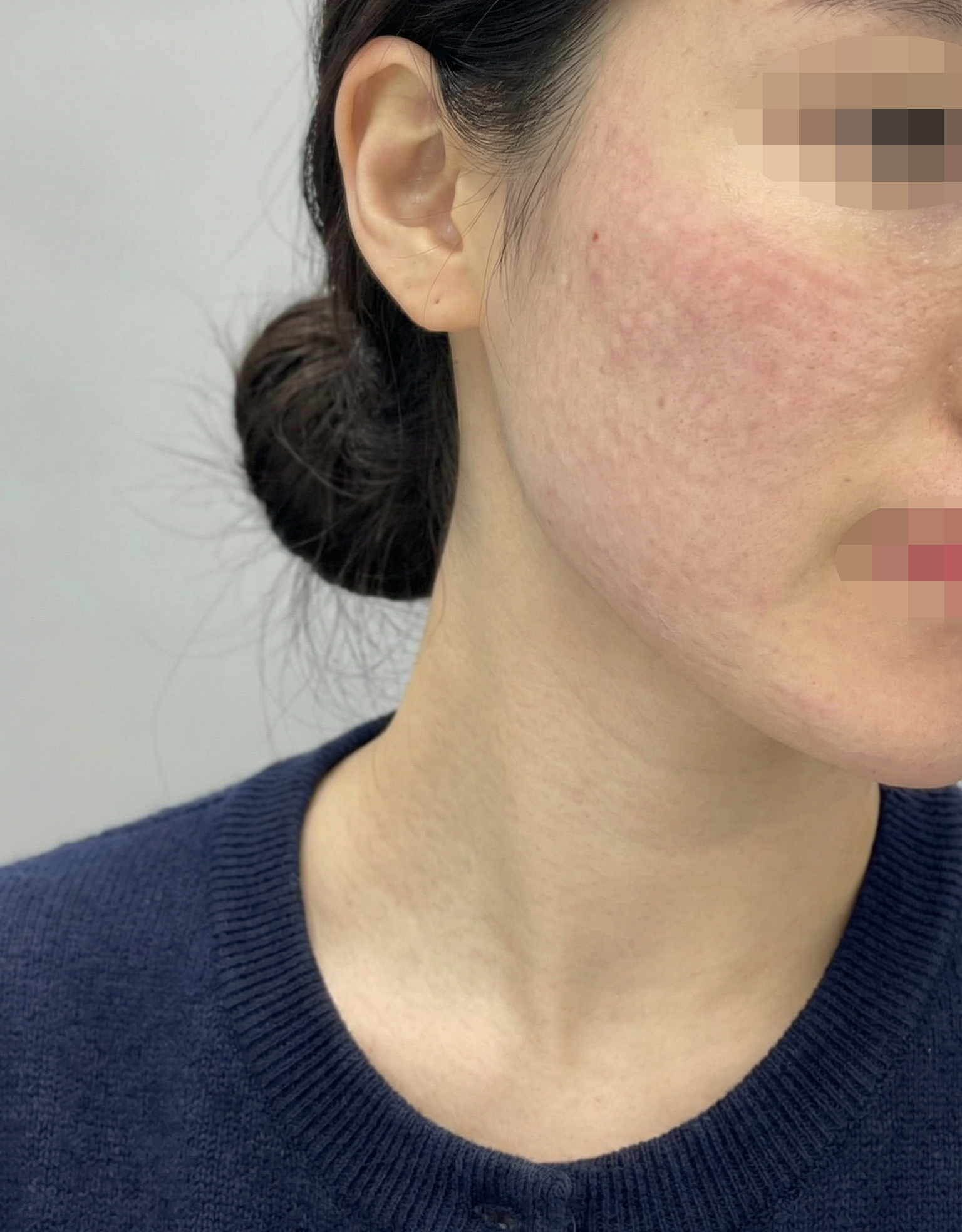 수술후기이미지