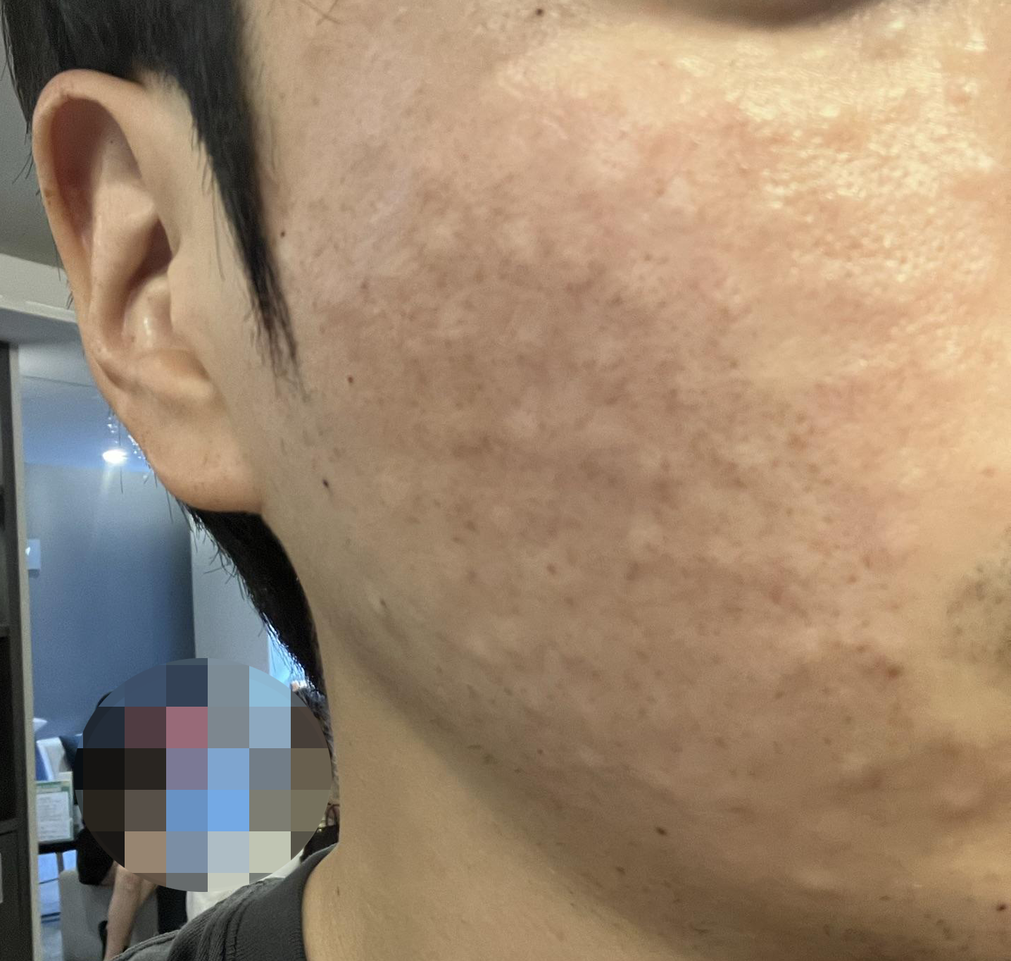 수술후기이미지