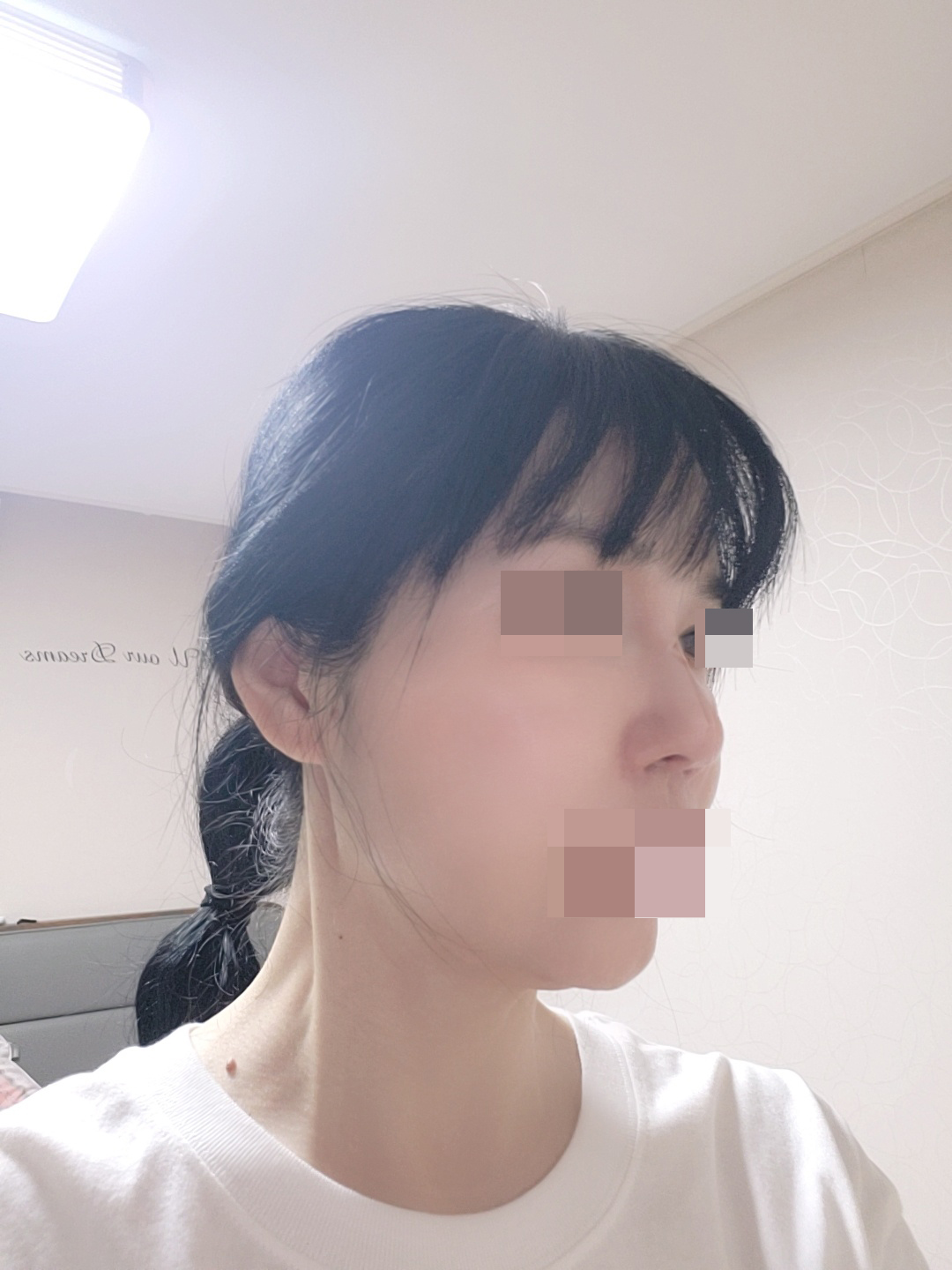 수술후기이미지