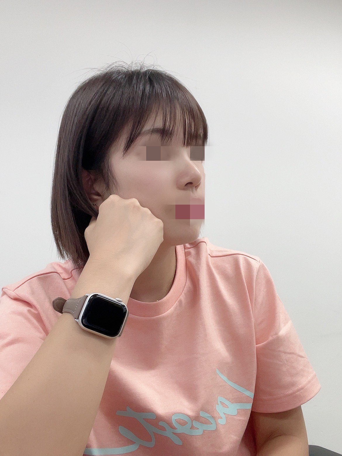 수술후기이미지