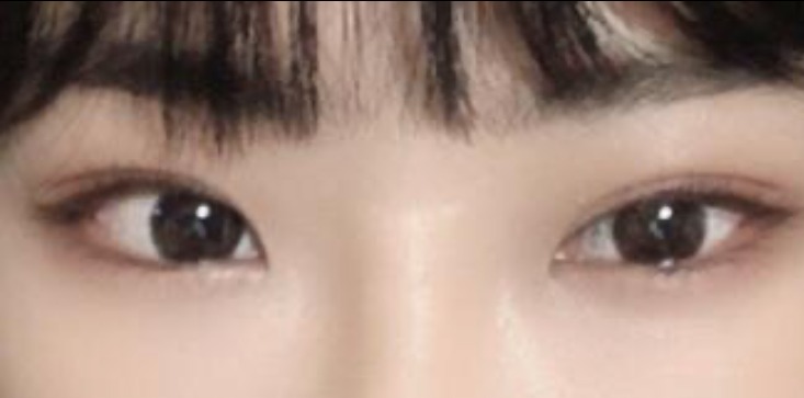 수술후기이미지