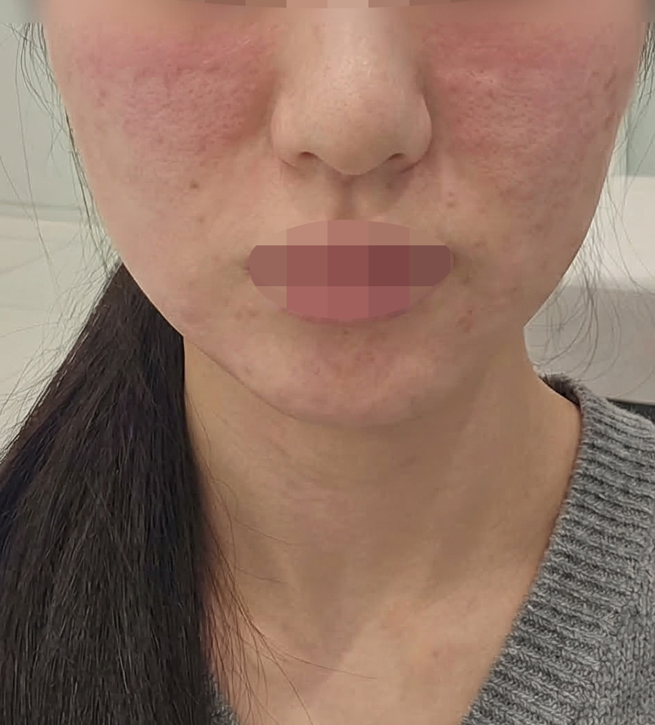 수술후기이미지