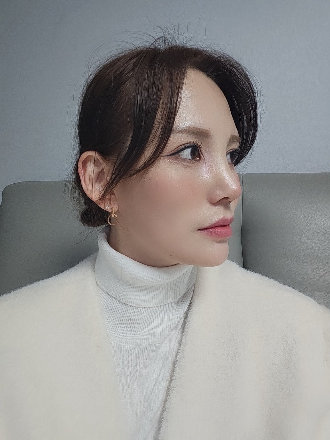 수술후기이미지