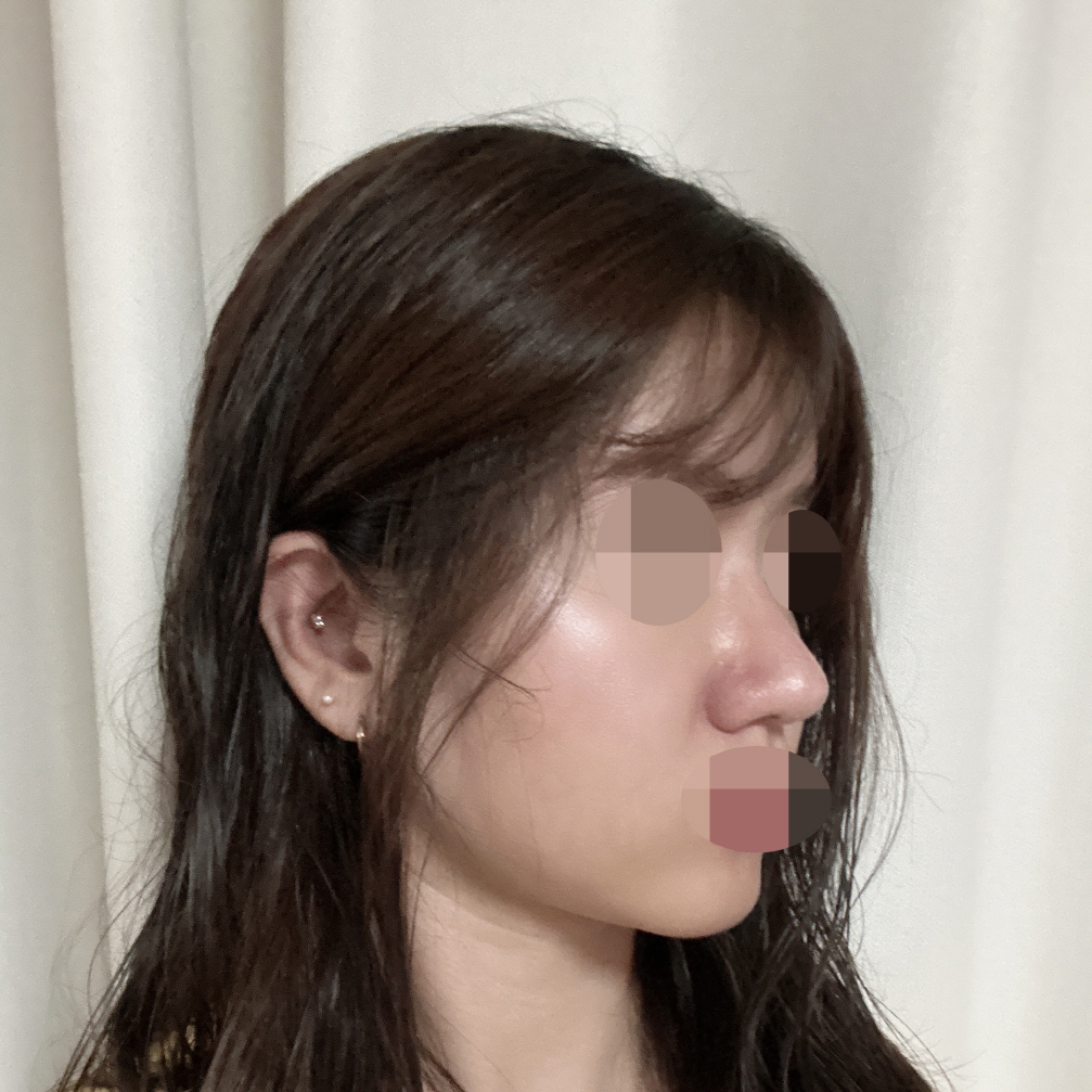 수술후기이미지