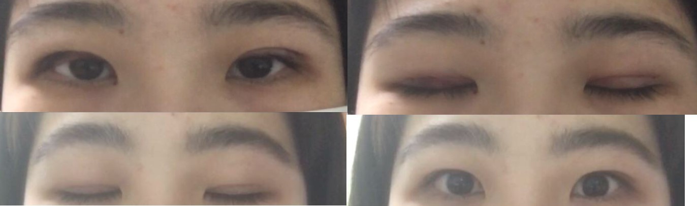 수술후기이미지