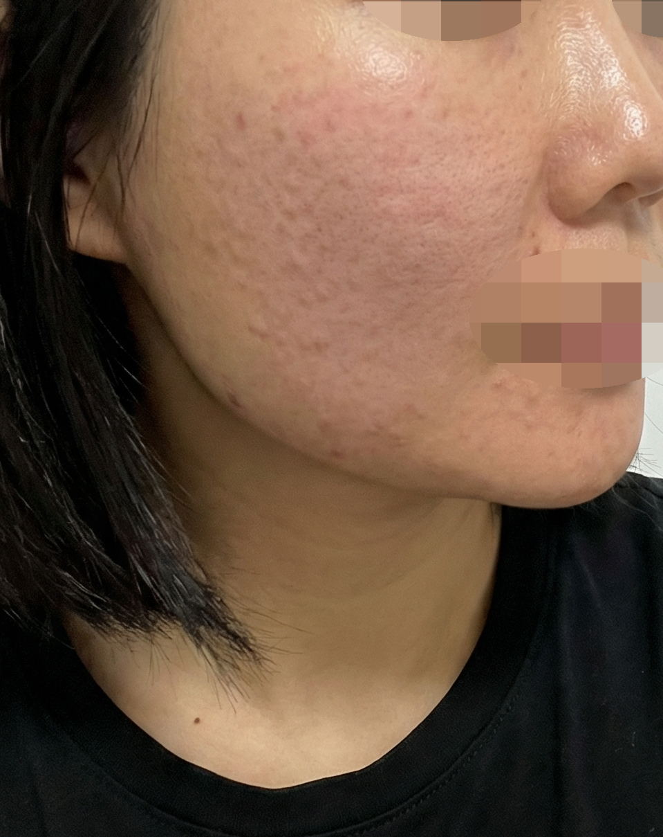 수술후기이미지