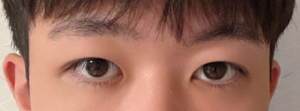 수술후기이미지