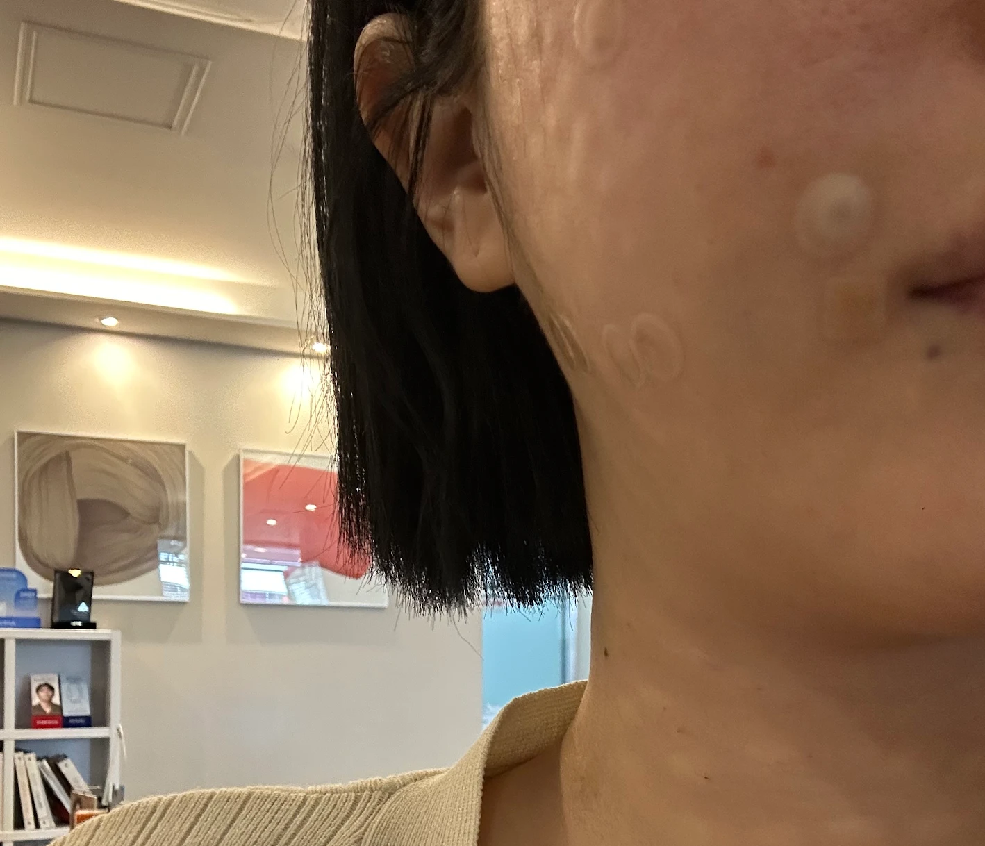 수술후기이미지